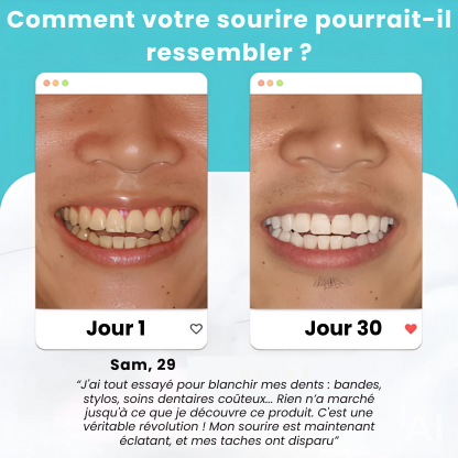 Brosse Electrique